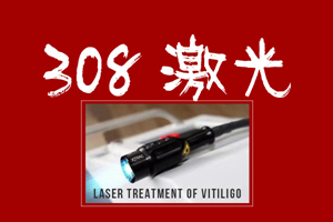 [專業(yè)咨詢]頸部可以用308照光嗎-308激光治療費用如何