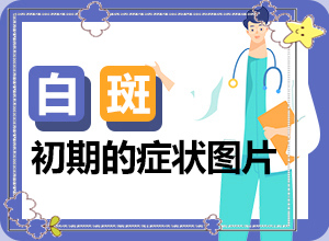 兒童臉部白癲風(fēng)怎么辦,發(fā)病前會(huì)有什么征兆(好發(fā)部位有哪些)