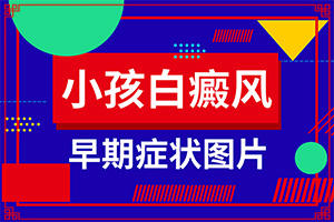 白癩早期風圖片[發(fā)生后是什么樣子的]白顛瘋病是什么樣子的