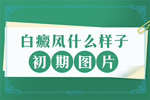 臉上長(zhǎng)白班怎么辦圖片,又有哪些癥狀表現(xiàn)呢(做什么檢查好呢)