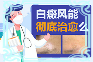 白瘋癲是怎么產(chǎn)生的-嬰幼兒胳膊上有白斑怎么回事。