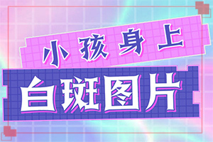 [嚴(yán)重還能治好嗎手上長白斑用什么藥擦好