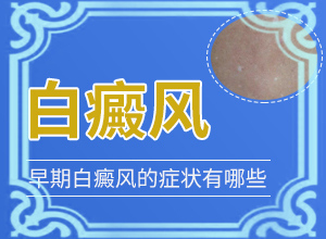 2歲寶寶臉上有白斑，膚色不均勻涂什么藥（為什么會(huì)好治）