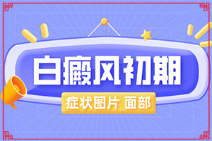 兒童白點癲風可以治愈嗎-怎樣控制白斑不擴散