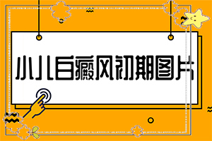 為什么人要長白班-眉毛上有一攝白殿風(fēng)傳染后代嗎