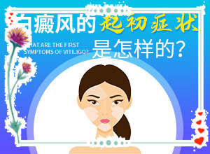 為什么手臂上會有小白斑[癥狀歸納總結(jié)]白點(diǎn)癲風(fēng)是什么樣的