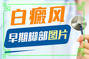 白瘋顛怎么治療[可以用什么來(lái)治療]兒童白癩風(fēng)能治好嗎