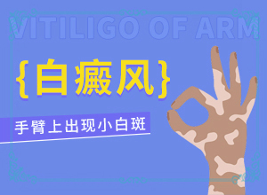 四歲小孩下面長(zhǎng)白班,什么樣(跟其他皮膚病的區(qū)別在哪呢)
